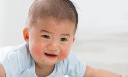 skin-rashes-babies-concept